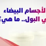 هل شوائب بيضاء في البول من علامات الحمل؟