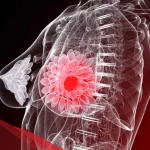 هل ارتفاع هرمون الحليب يسبب دوخه وخمول