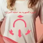 الدورة الشهرية بعد عملية المرارة كيف تكون؟