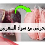 تجربتي مع سواد الشفرتين وطريقة توريدها بوصفات طبيعية
