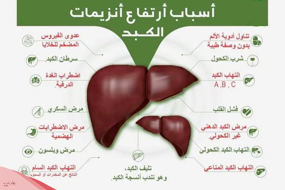 تجاربكم مع ارتفاع انزيمات الكبد للحامل