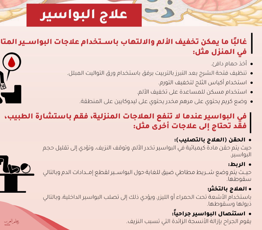 تجاربكم مع البواسير بعد الولاده: الأسباب وطريقة العلاج