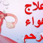 علاج هواء الرحم وقت الدورة بالاعشاب وأبرز 3 طرق للوقاية من غازات الرحم