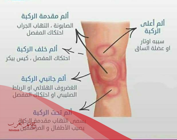 أفضل مرهم لعلاج آلام الركبة من الصيدلية