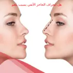 هل انحراف الحاجز الأنفي يسبب بلغم