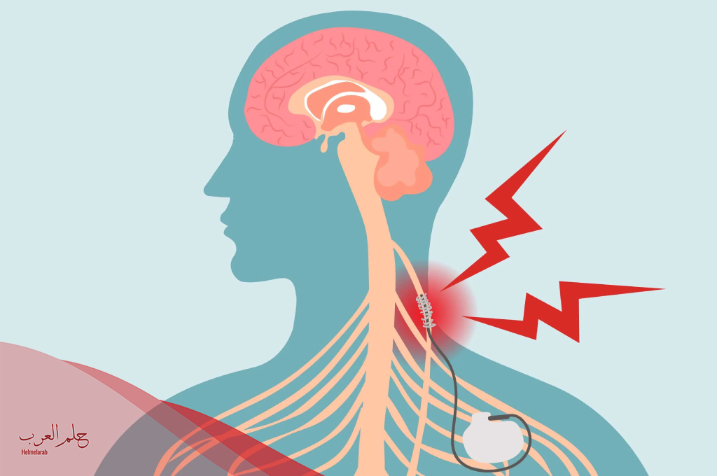 تجربتي مع العصب الحائر وطرق علاجه تجربتي مع العصب الحائر وطرق علاجه