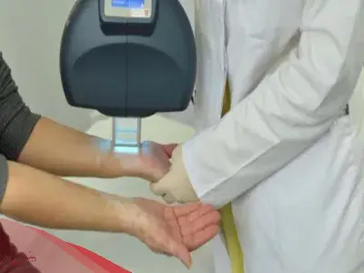 تجربتي في علاج البهاق بالليزر وهل له اضرار