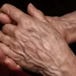 تجربتي لاخفاء عروق اليدين