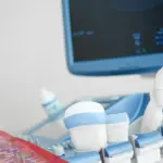 تجربتي مع متابعة التبويض بالسونار بالتفصيل