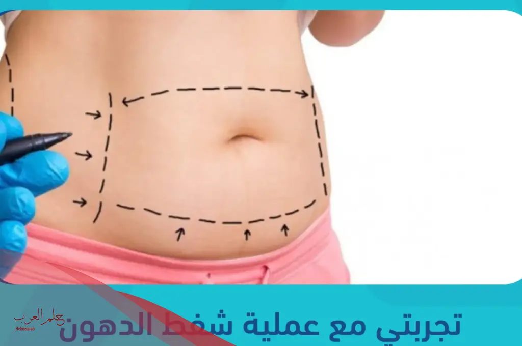 تجربتي مع شفط البطن للداخل وهل فعلاً يزيل الكرش؟