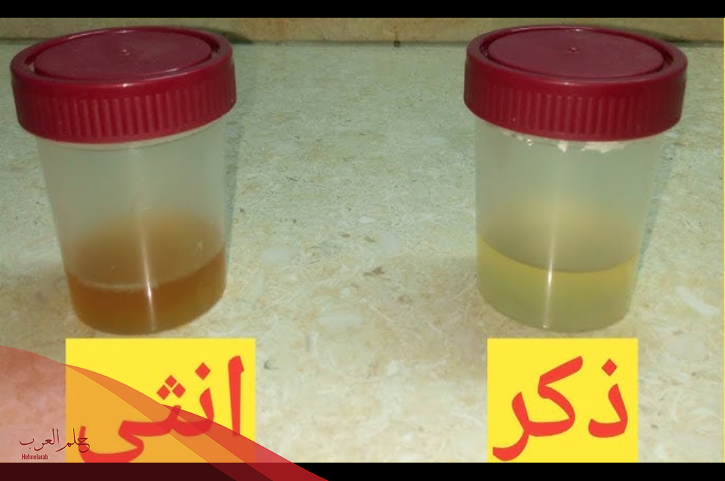 تجاربكم مع لون البول وجنس الجنين