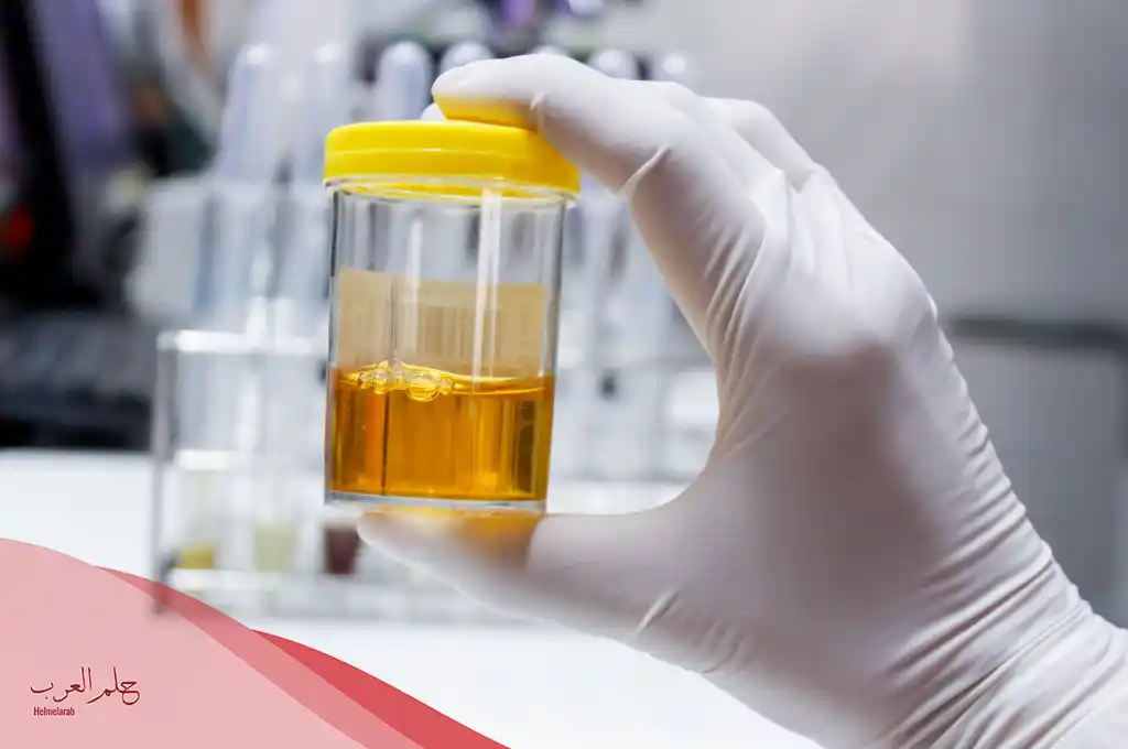 نسبة كريات الدم الحمراء في البول 8 10 وكم النسبة الطبيعية