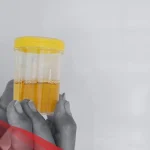 تجاربكم مع لون البول وجنس الجنين