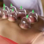 علامات نجاح الحجامة ابرز فوائدها