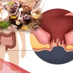 علاج سريع المفعول للشرخ بالاعشاب