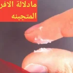 أسباب خروج مادة بيضاء متكتله من المهبل