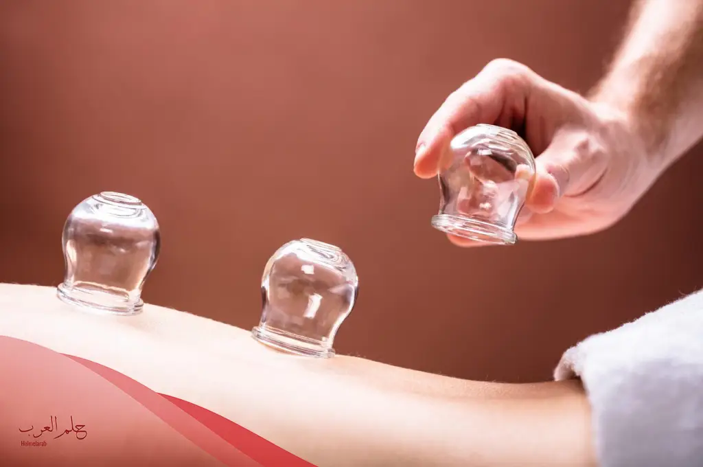 الحجامه للحمل متى وقتها