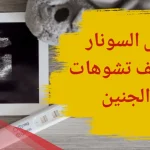هل تشوهات الجنين تظهر في السونار العادي