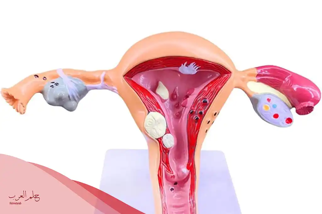 هل الدم المتجمد في الرحم يمنع الحمل وعلامات تجمع الدم في الرحم