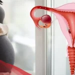 هل الدم المتجمد في الرحم يمنع الحمل وعلامات تجمع الدم في الرحم