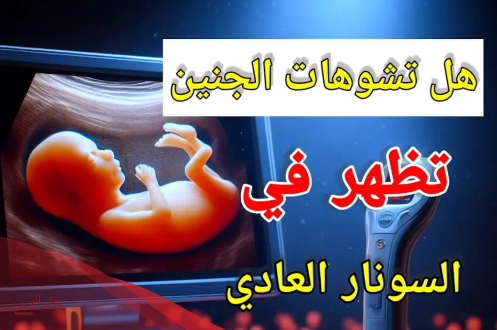 هل تشوهات الجنين تظهر في السونار العادي
