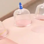 الحجامه للحمل متى وقتها الصحيح والفعال للنساء؟
