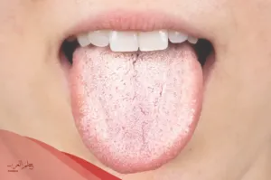 ما هي علاقة مرارة الفم والكبد؟