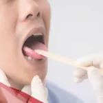 ما هي علاقة مرارة الفم والكبد؟