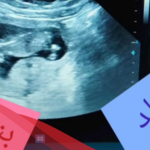 كيف اعرف نوع الجنين في الشهر الثالث بدون سونار  