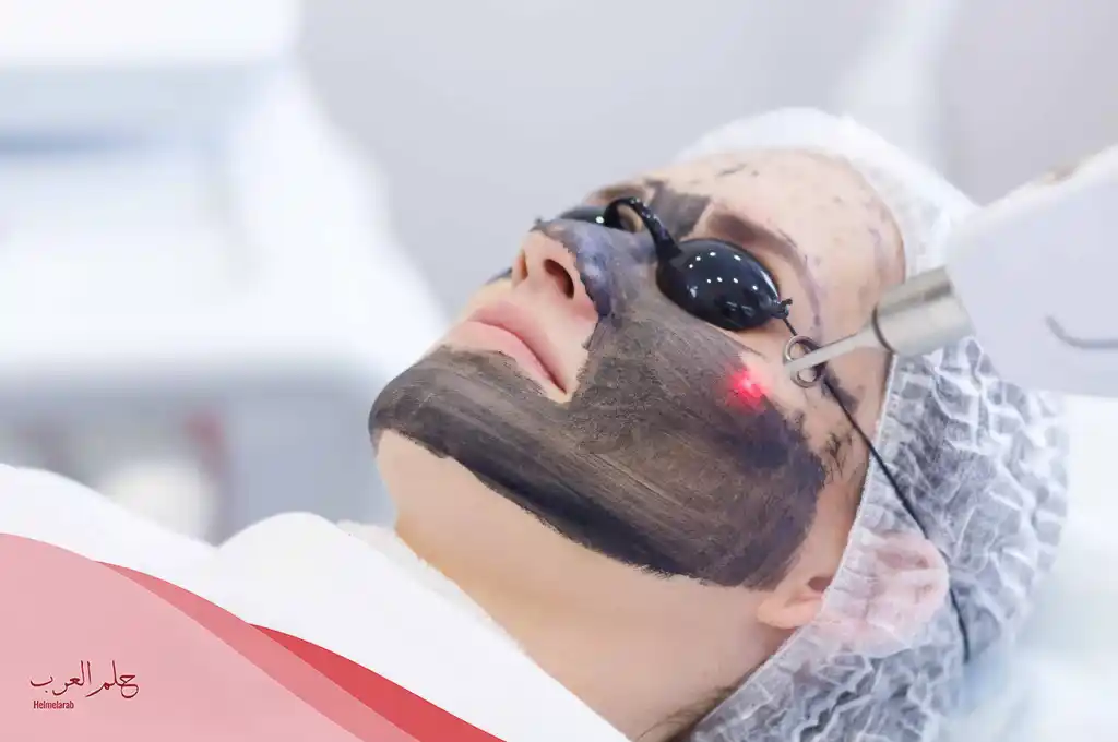 متى تظهر نتائج الليزر الكربوني