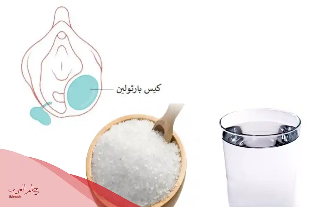 تجربتي مع الماء والملح لغدة بارثولين