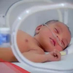 افضل حليب للخدج وناقصي الوزن
