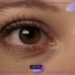 لعلاج الهالات السوداء.. نصائح فعالة للتخلص من الهالات السوداء بشكل نهائي