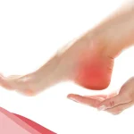 علاج التهاب اللفافة الاخمصية بالحجامة