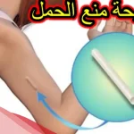 هل شريحة منع الحمل تزيد الوزن