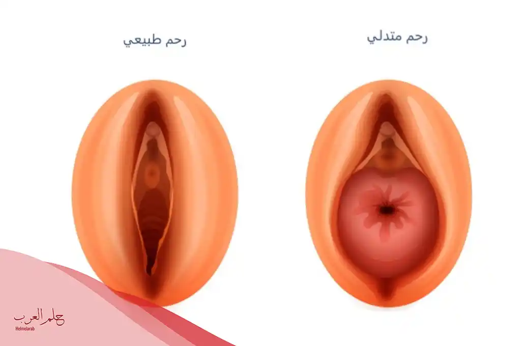 كيف اعرف اني حامل عن طريق المهبل