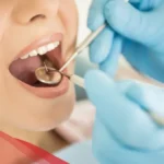 كم راتب طبيب الاسنان في القطاع الخاص مع البدلات 2024